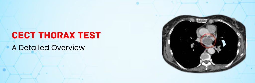  CECT Thorax Test: A Detailed Overview